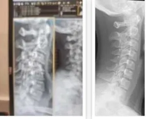 Normal and mine